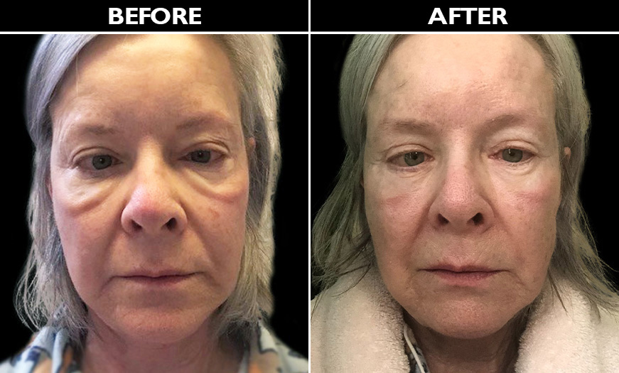 A comparison of a person's faceDescription automatically generated