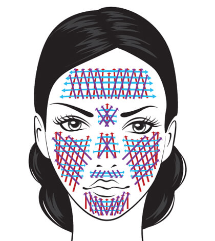 Microneedling Target Areas